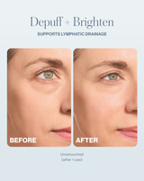 DERMAFLASH COOL - before and after results from DERMAFLASH COOL showing less puffy face