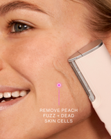 DERMAFLASH LUXE+ - Blush | LUXE+ Sonic Dermaplaning device in Blush